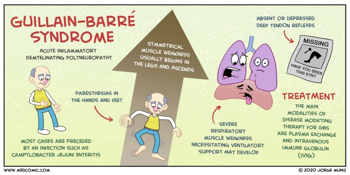 Syndrome barre guillain