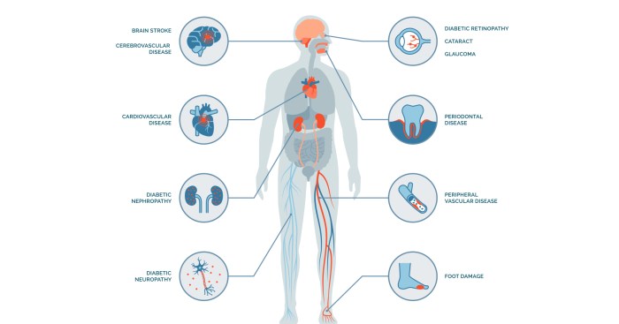 Shadow health hypertension and type 2 diabetes